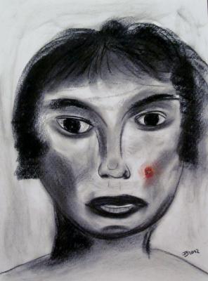 Dame mit Eiterpickel - Juergen Schneider - Array auf Array - Array - 